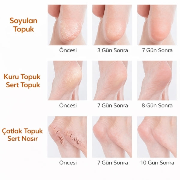 Nemlendirici Topuk Çorabı