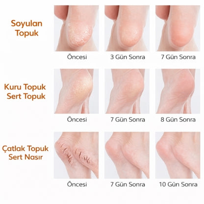 Nemlendirici Topuk Çorabı