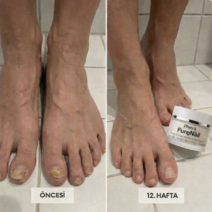 Pheva - PureNail™