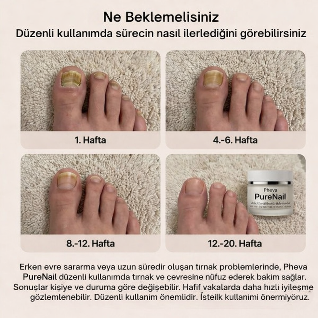 Pheva - PureNail™