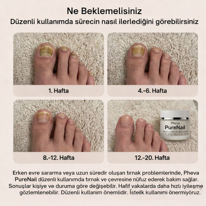 Pheva - PureNail™